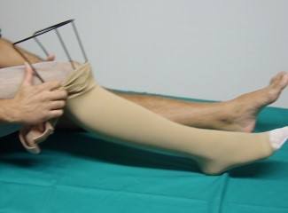 Step 3: Procedimento per utilizzare l'infila calze Flebysan